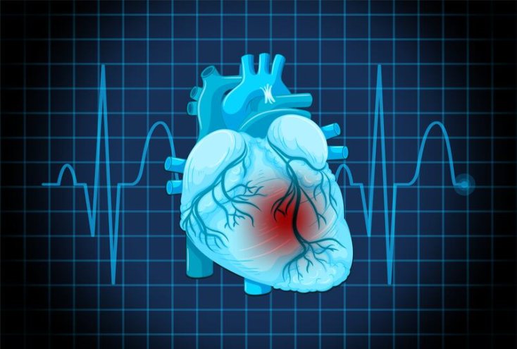 Facts About Cardiac Calcium Screening